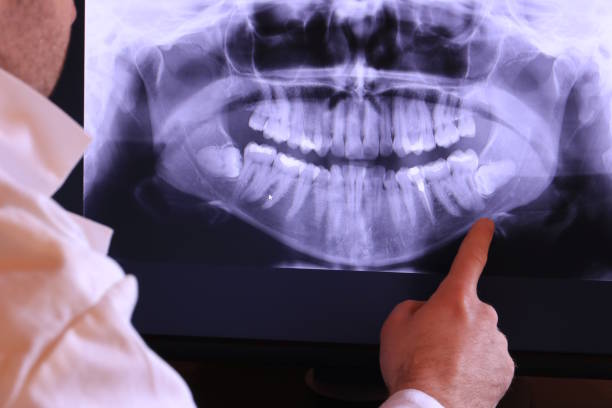 Best Broken or Chipped Tooth Repair in Chadron, NE