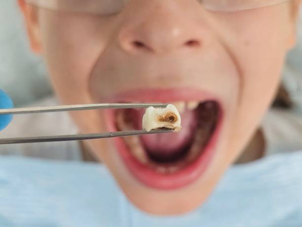 Best Walk-In Emergency Dental Services in Chadron, NE