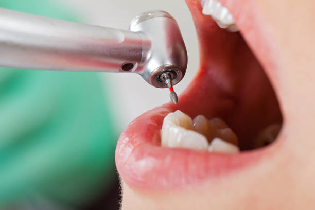 Best Emergency Dental Care for Sports Injuries in Chadron, NE